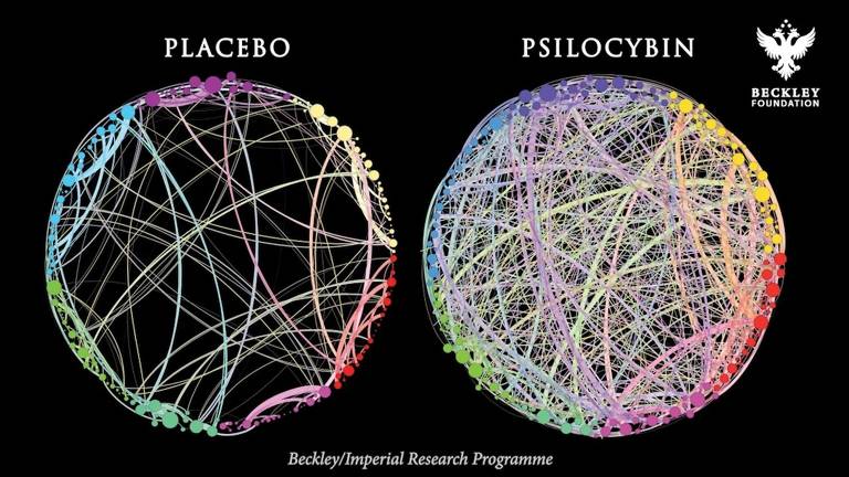 Visualizações da ação do placebo e da psilocibina no cérebro