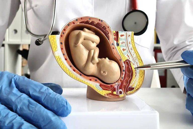 A imagem mostra um modelo anatômico de um útero humano com um feto dentro. O modelo está sendo segurado por uma pessoa que usa luvas azuis e um jaleco branco de médico. Um estetoscópio está pendurado no pescoço da pessoa, indicando que se trata de um profissional de saúde. 