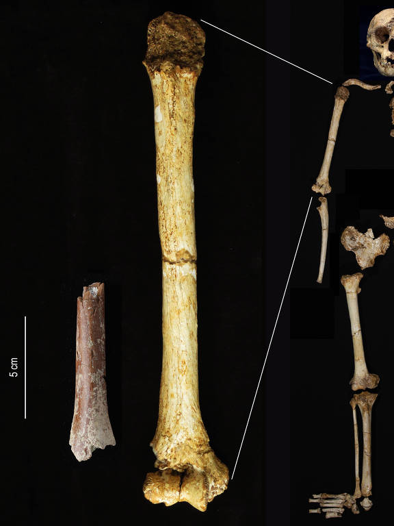 A imagem mostra um esqueleto humano em pé ao lado de um osso longo, possivelmente um fêmur, e um osso menor à esquerda. O fundo é preto, destacando os elementos. O esqueleto está posicionado de forma a mostrar sua estrutura óssea.