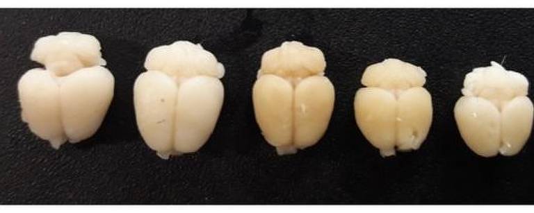 Comparação entre cérebros de camundongos. Os afetados pela zika são menores em relação aos normais