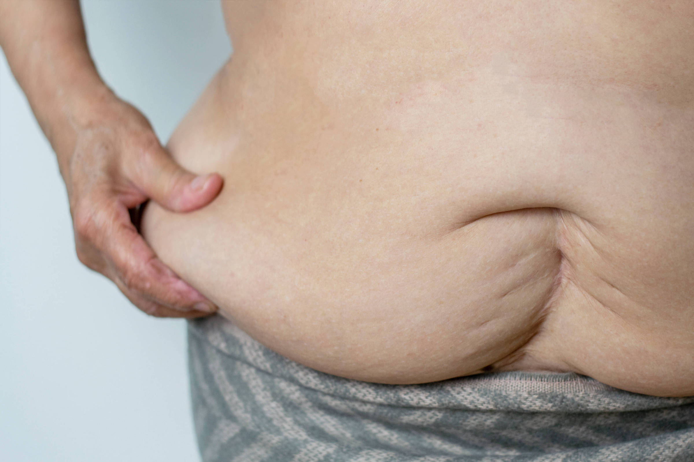 Gordura na barriga provoca danos cardíacos mais graves do que o peso total, aponta estudo