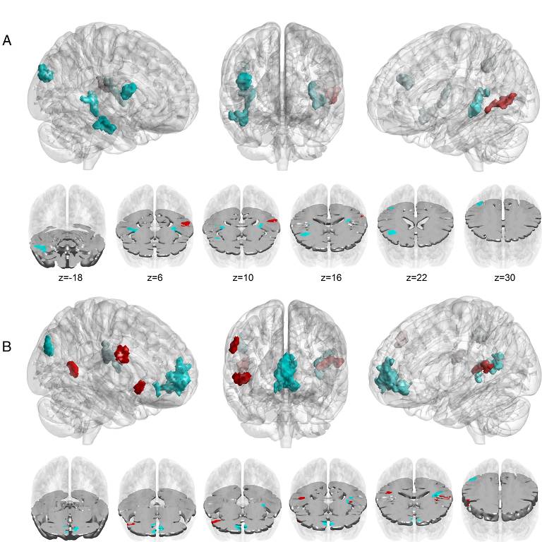 A imagem apresenta duas seções (A e B) de representações cerebrais em diferentes cortes. As áreas ativadas são mostradas em cores: vermelho indica 'MUS > NMUS', enquanto azul claro indica 'NMUS > MUS'. As seções incluem vistas laterais e cortes transversais em diferentes níveis de z, variando de -18 a 30. As áreas ativadas são destacadas em um fundo cinza claro, permitindo a visualização das diferenças de ativação entre os dois grupos.