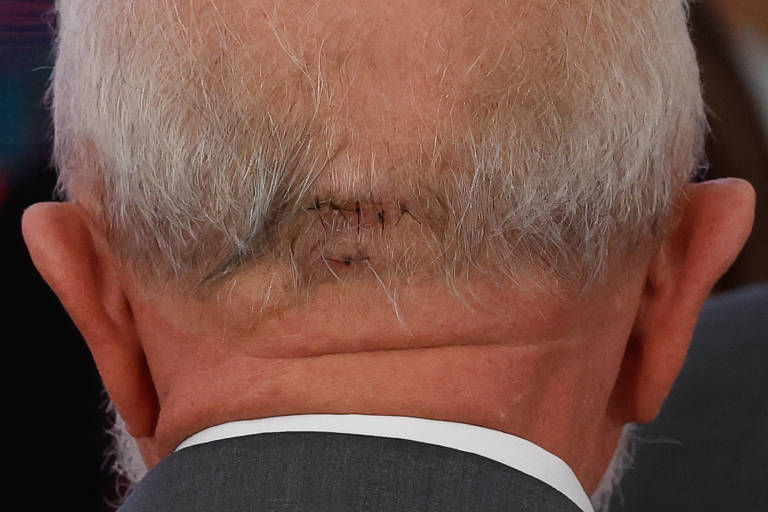 Presidente Lula cancela viagem à Rússia após sofrer queda no banheiro e levar pontos na cabeça