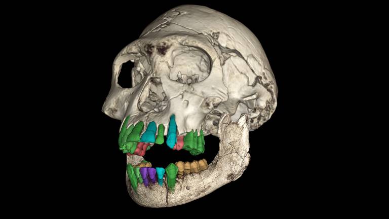 A imagem mostra um crânio humano em perfil, com os dentes destacados em cores diferentes, como verde, azul e roxo. O fundo é preto, destacando a estrutura óssea do crânio e os dentes coloridos.