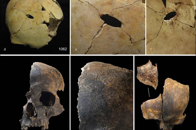 A imagem apresenta uma série de fotografias de crânios e fragmentos ósseos， numerados de a a i. As imagens mostram diferentes ângulos e detalhes de crânios， incluindo buracos， rachaduras e texturas na superfície. Os crânios parecem ter variações em cor e estado de preservação， com alguns apresentando danos visíveis e outros com características mais intactas.