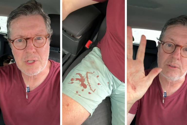 A imagem mostra um homem sentado dentro de um carro. Ele está usando uma camiseta vinho e calças verdes. O homem tem cabelo grisalho e usa óculos. Há manchas de sangue visíveis em sua calça e em sua mão. No fundo, pode-se ver um cachorro pequeno ao lado dele. O homem parece estar falando e gesticulando com a mão levantada.