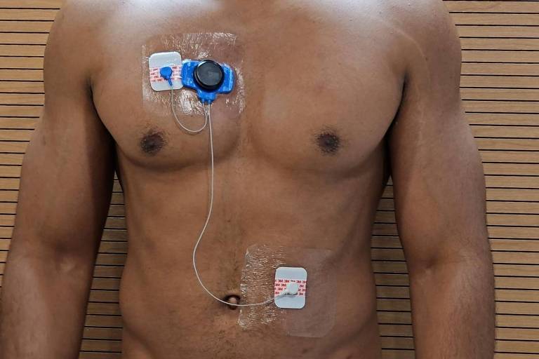 A imagem mostra o torso de um homem nu， com dispositivos médicos adesivos aplicados em seu peito. Um dos dispositivos é circular e azul， enquanto outro é retangular e branco， ambos conectados por fios. O fundo é de madeira com ripas horizontais.