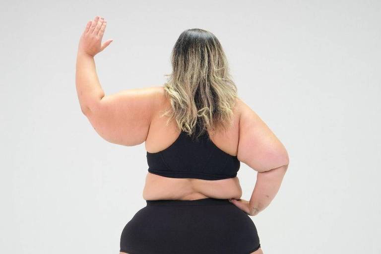 Mulher de costas mostra braços afetados pelo lipedema
