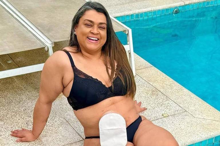 Preta Gil sorrindo na beira de piscina， com bolsa de colostomia no abdômen
