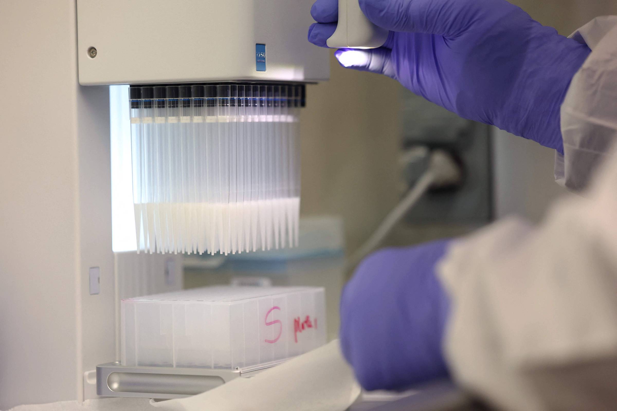 Morador de Washington morre no primeiro caso confirmado de gripe aviária do estado, diz departamento de saúde