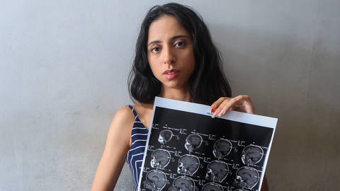 NATAL,RN - 15/3/2025 - Débora Gomes de Oliveira Silva, 21, segura seus exames. Ela sofreu um acidente doméstico em novembro de 2024. Após bater a cabeça no chão de casa, perdeu a consciência por alguns instantes. Ao acordar, não reconhecia o próprio namorado nem o filho de 4 anos. Além das lembranças afetivas, também esqueceu experiências profissionais e acadêmicas, incluindo a faculdade de pedagogia.  (FOTO: Alexandre Lago/Folhapress). ***Exclusivo Folha de São Paulo***