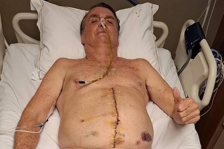 Bolsonaro mantém melhora, mas segue sem previsão de alta da UTI