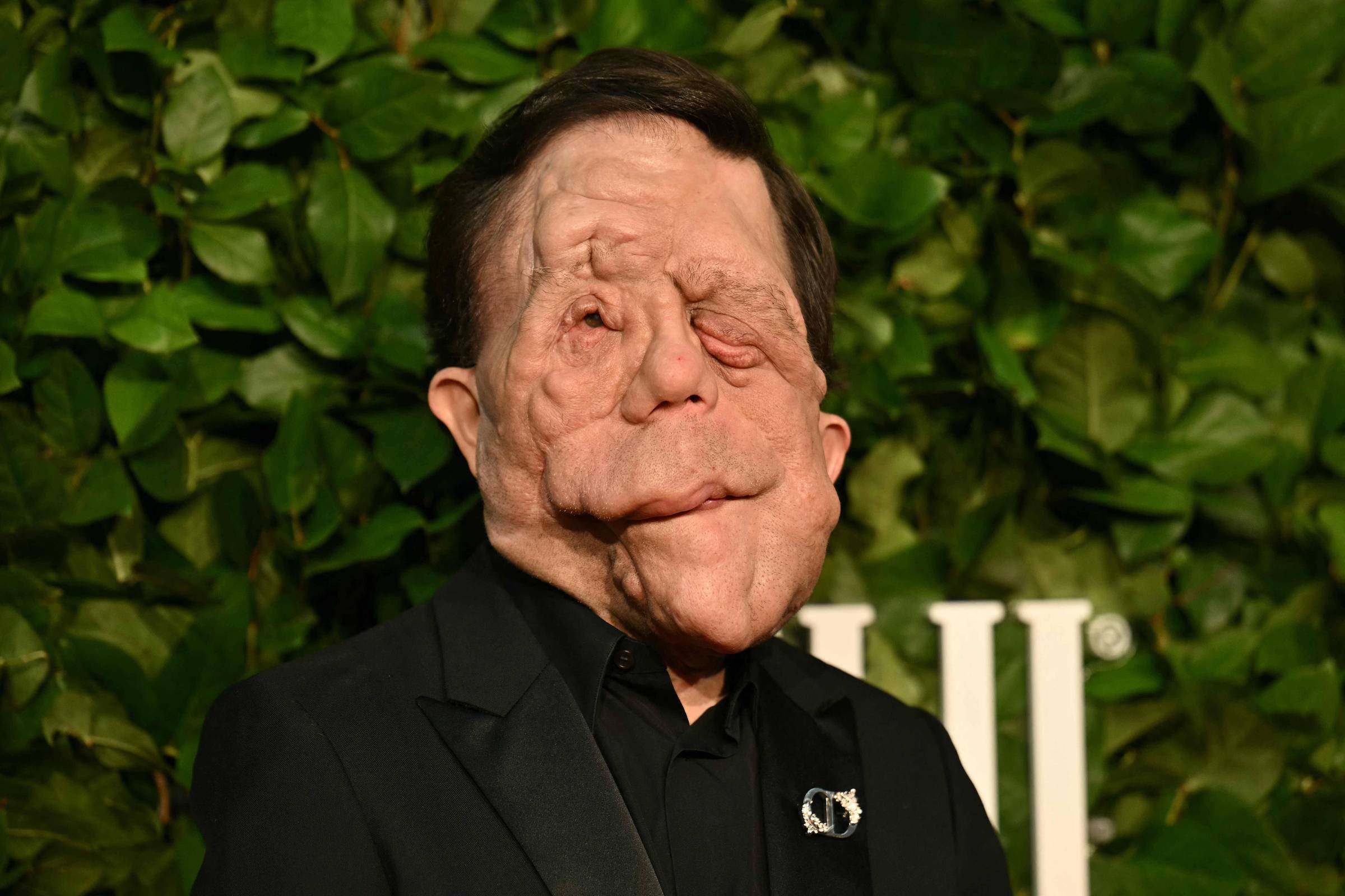 Adam Pearson viverá o Homem Elefante em nova adaptação para os cinemas