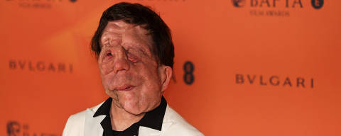 Adam Pearson poses at the Nominees Party for the 2025 BAFTA Film Awards at the National Gallery in London, Britain, February 15, 2025. REUTERS/Carlos Jasso ORG XMIT: LIVE