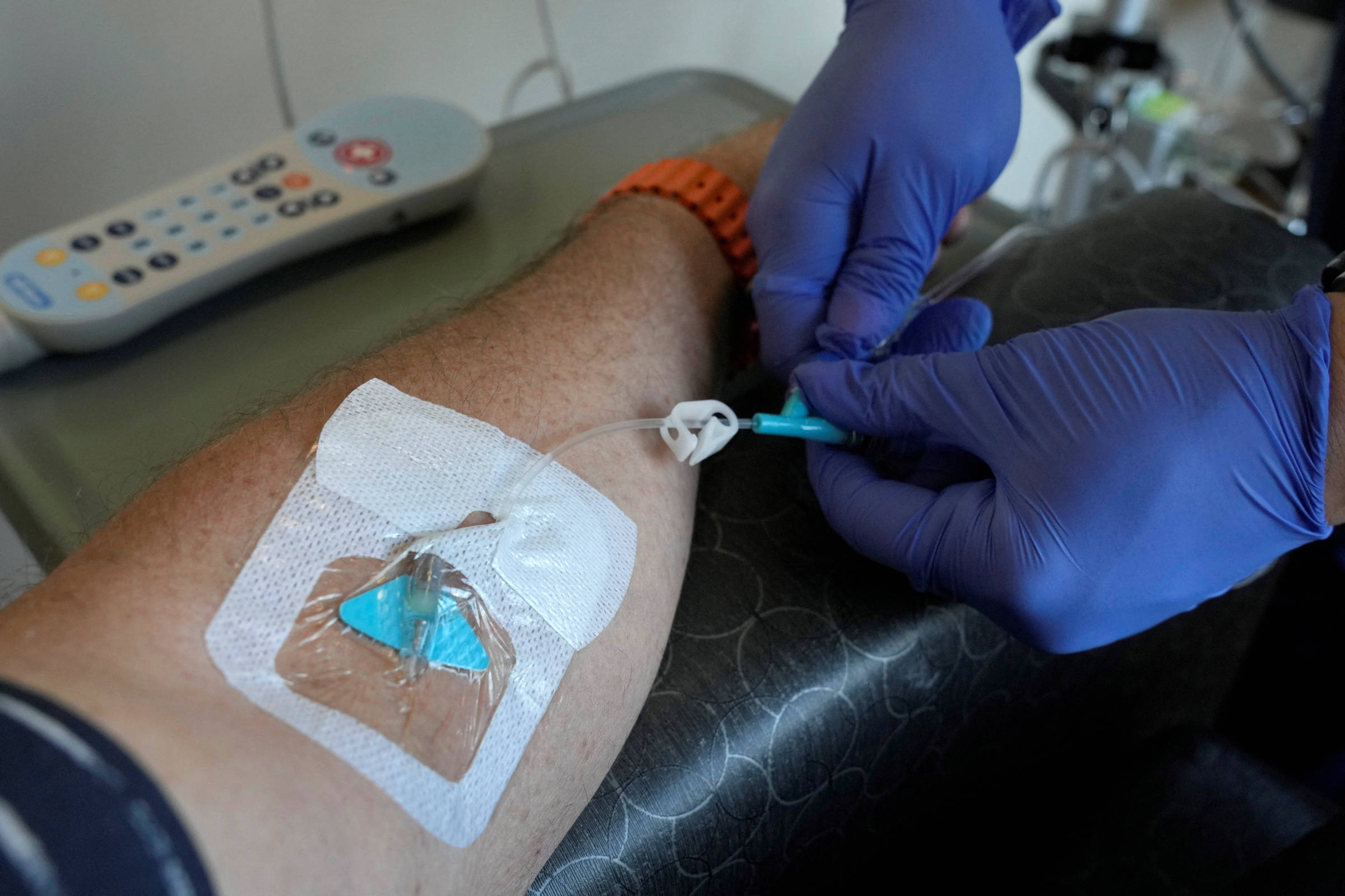 Tatuagens, narguilé: veja cinco fatores que podem estar ligados ao câncer
