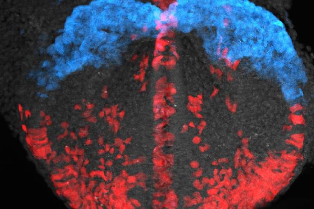 Cientistas filmam formação do coração em 3D pela primeira vez