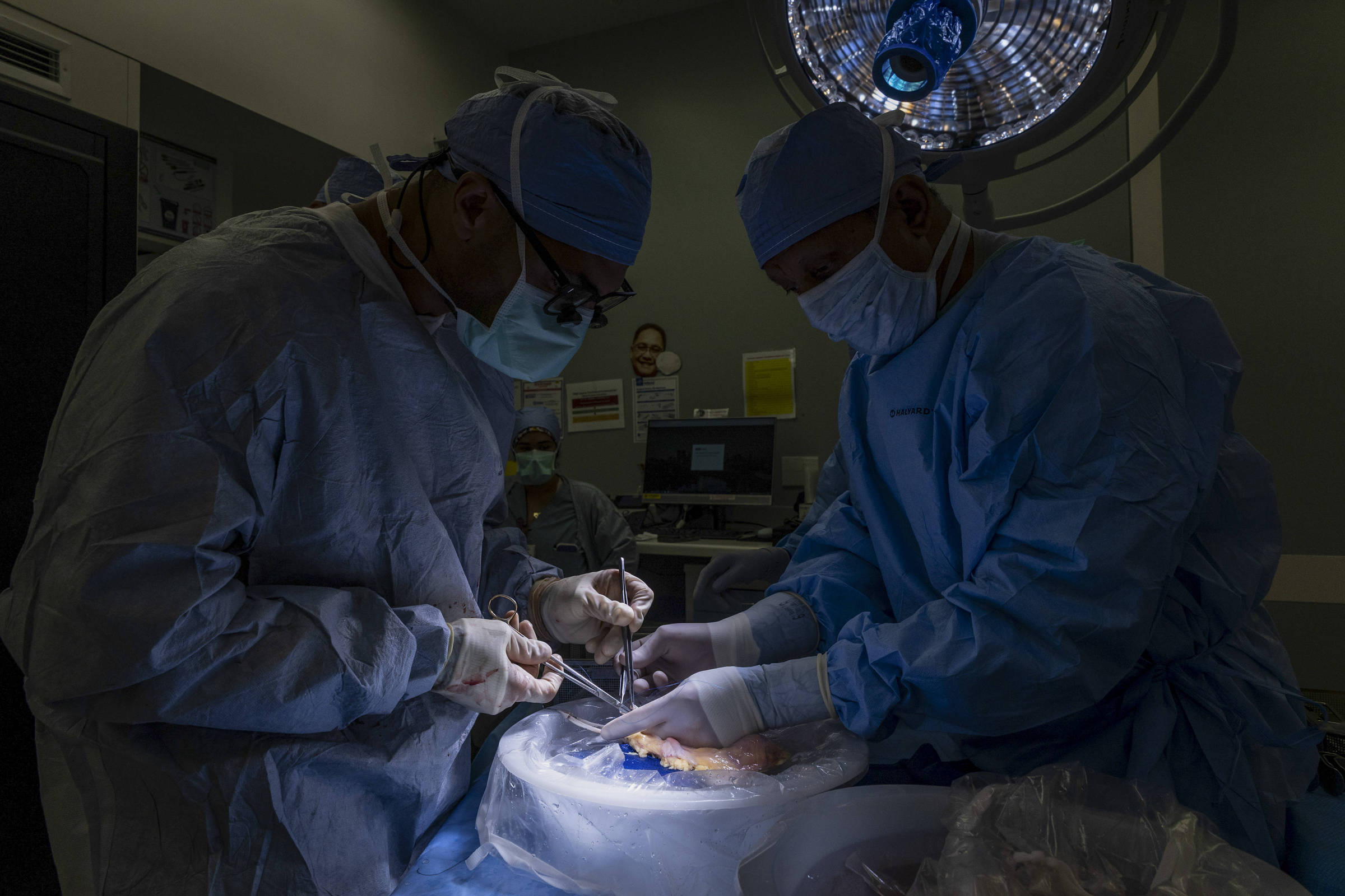 Cirurgiões dos EUA realizam primeiro transplante de bexiga humana