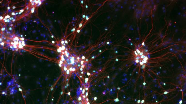 Empresas como a Cortical Systems trabalham em 'organoides' feitos de células nervosas