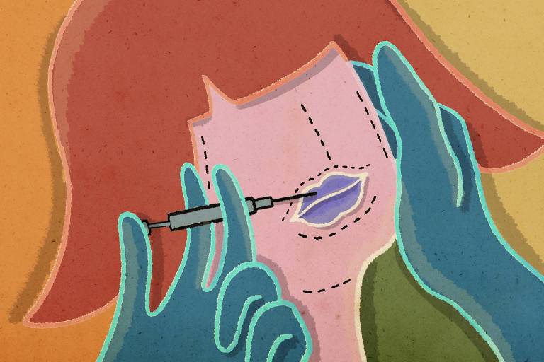 Botox preventivo funciona? Quanto custa? Tire dúvidas sobre o procedimento