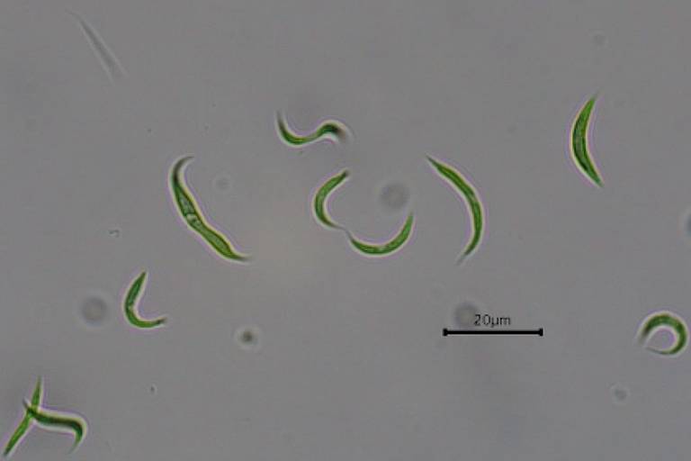 A imagem mostra várias algas microscópicas em um fundo claro. As algas têm formas variadas, algumas são alongadas e outras mais arredondadas, com uma coloração verde predominante. Há uma barra de escala na parte inferior da imagem, indicando 20 micrômetros.