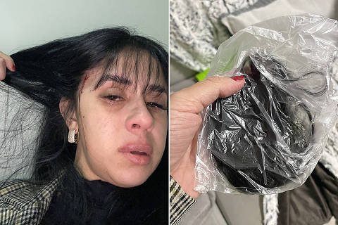 MONTAGEM, A cantora de Blumenau (SC) Débora Amorim, vítima de agressão na semana passada, mostra ferimentos e parte do cabelo cortado
( Foto: Arquivo pessoal ) DIREITOS RESERVADOS. NÃO PUBLICAR SEM AUTORIZAÇÃO DO DETENTOR DOS DIREITOS AUTORAIS E DE IMAGEM