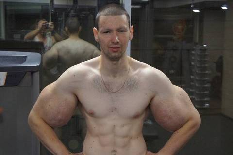 Kirill Tereshin ficou conhecido como 'Popeye russo' 