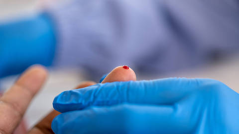 Close-up of a healthcare worker in blue gloves holding a patient's finger with a drop of blood during a medical examination or diagnostic blood test procedure.
( Foto: InveStock/adobe stock ) DIREITOS RESERVADOS. NÃO PUBLICAR SEM AUTORIZAÇÃO DO DETENTOR DOS DIREITOS AUTORAIS E DE IMAGEM