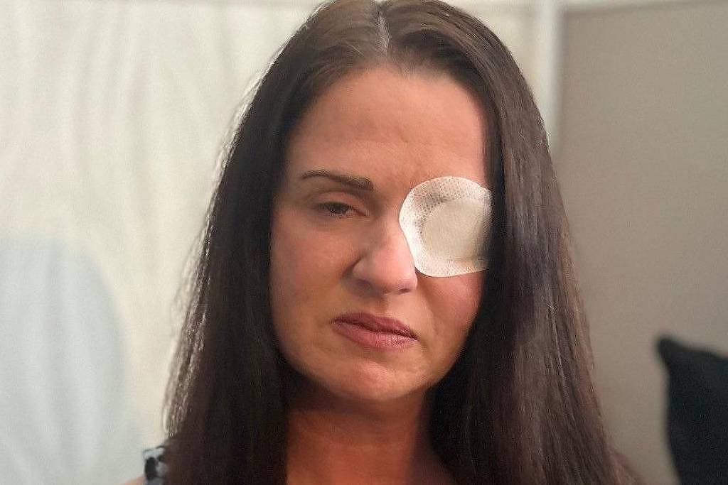 'Tive parada cardíaca e quase fiquei cega após esteticista me aplicar botox falso'