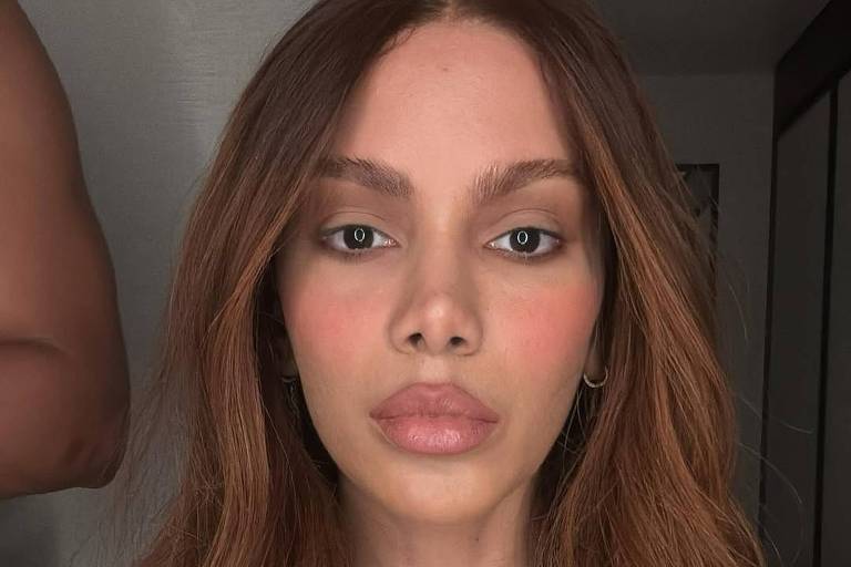 Novos procedimentos de Anitta priorizam naturalidade, dizem especialistas
