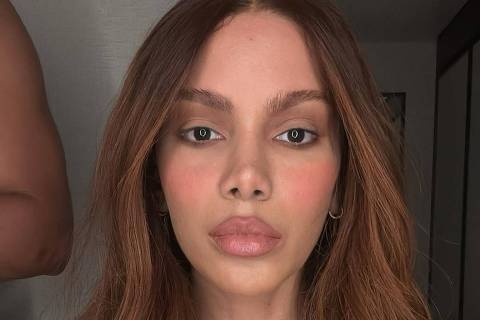 A cantora Anitta apareceu no Instagram com o rosto mais fino, a boca maior e as sobrancelhas mais arqueadas