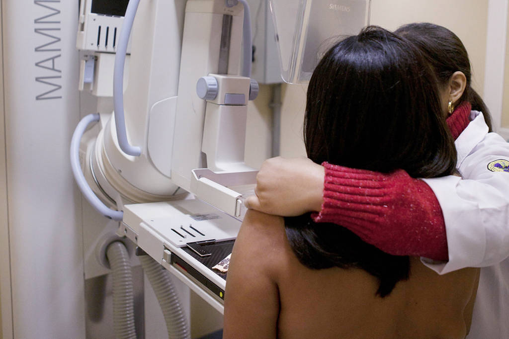 Senado aprova projetos que antecipam idade mínima para mamografia no SUS