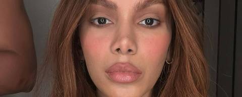 A cantora Anitta apareceu no Instagram com o rosto mais fino, a boca maior e as sobrancelhas mais arqueadas
