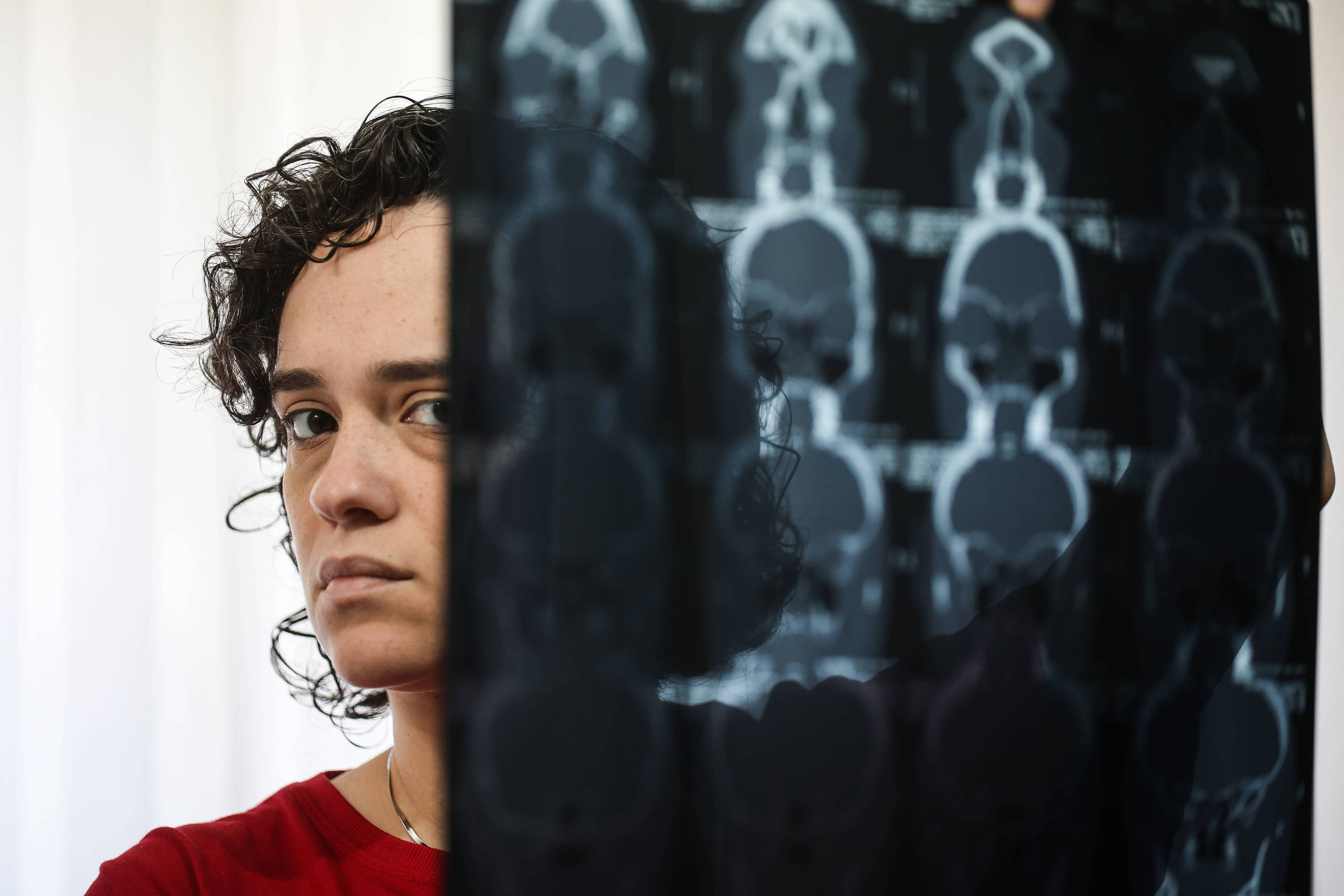 Entenda o que é a síndrome da fadiga crônica, doença que causa cansaço extremo