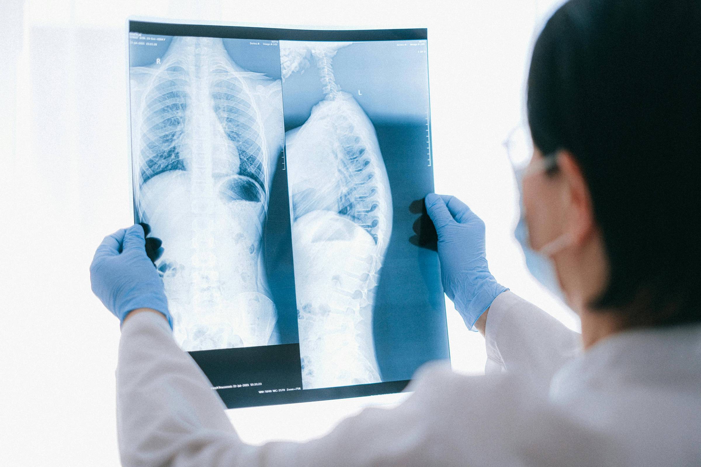 Casos de síndrome respiratória desaceleram no país, apesar dos números altos