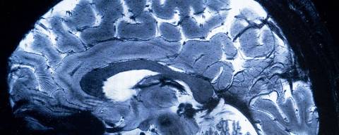 This image made with the Iseult Magneton 11.7 T MRI shows a brain during a magnetic resonance imaging (MRI) exam simulation at the Neurospin facilities in the Paris-Saclay Alternative Energies and Atomic Energy Commission (CEA - Commissariat a l'energie atomique et aux energies alternatives) centre in Gif-sur-Yvette, on March 22, 2024. 