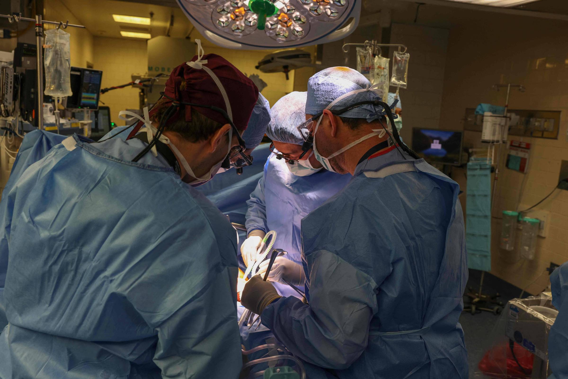 Estudo identifica por que organismo humano rejeita transplante de rim de porco