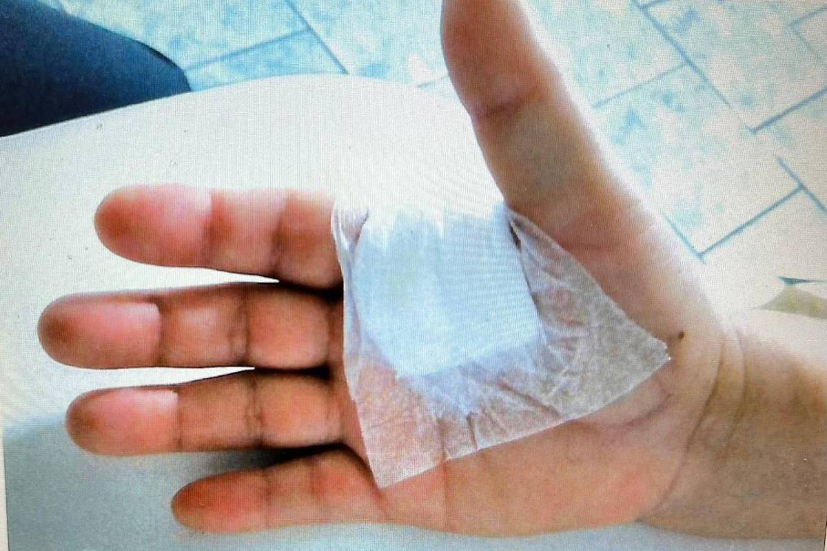 Médico é condenado em SP por operar dedo errado de paciente