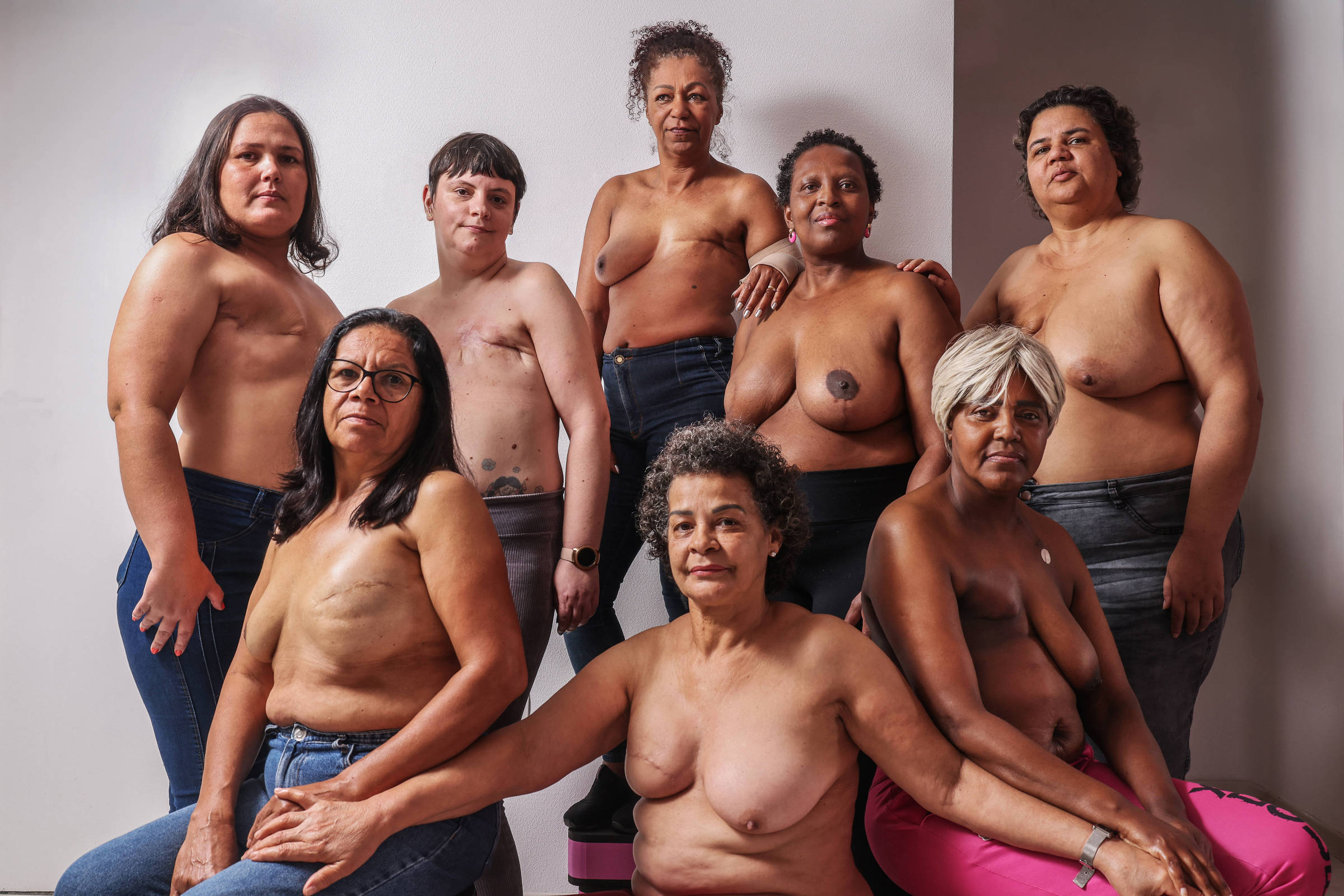 Projeto oferece reabilitação gratuita a pacientes que retiraram mama no SUS