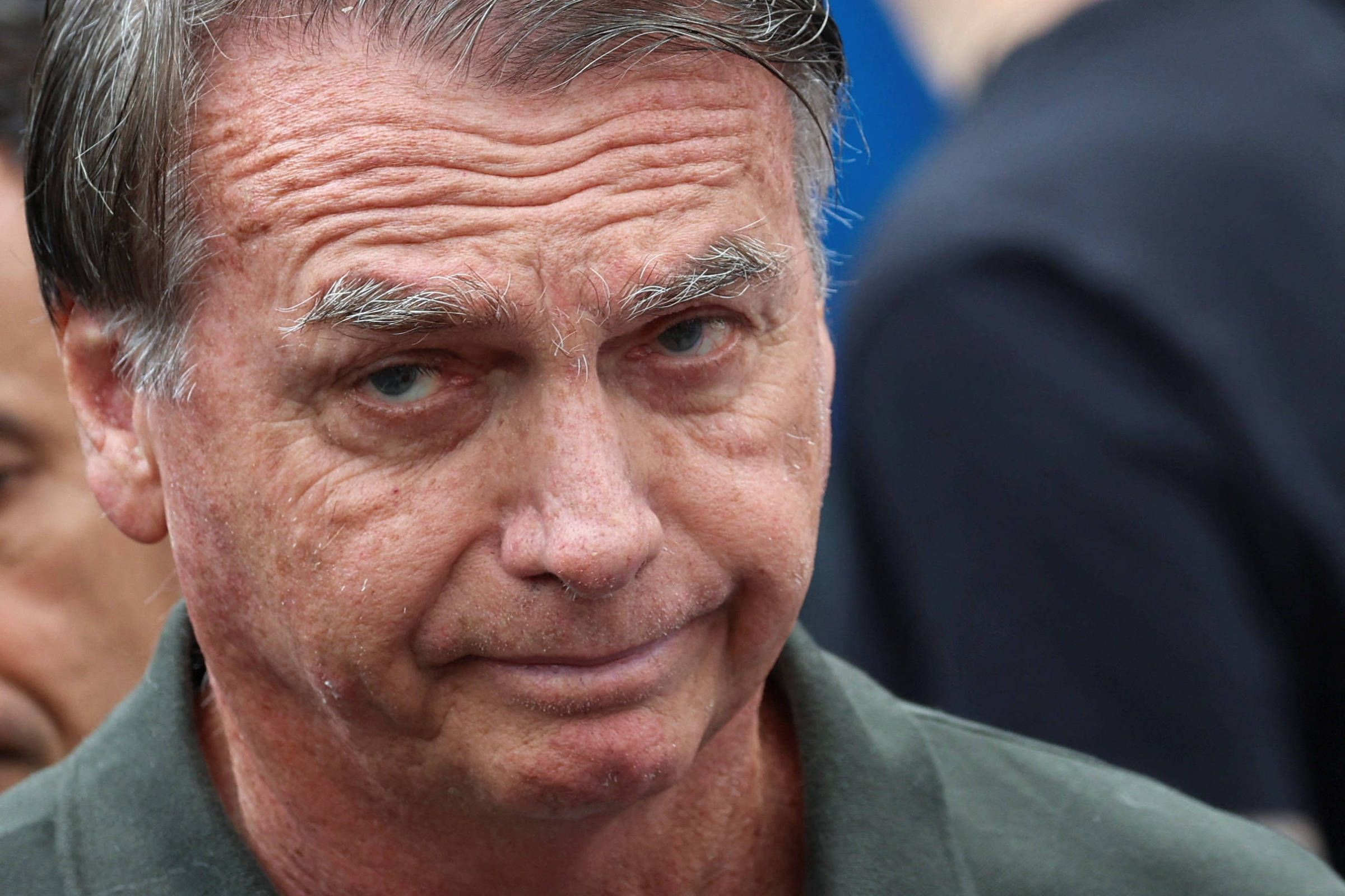 Bolsonaro retira lesões na pele; entenda o procedimento médico