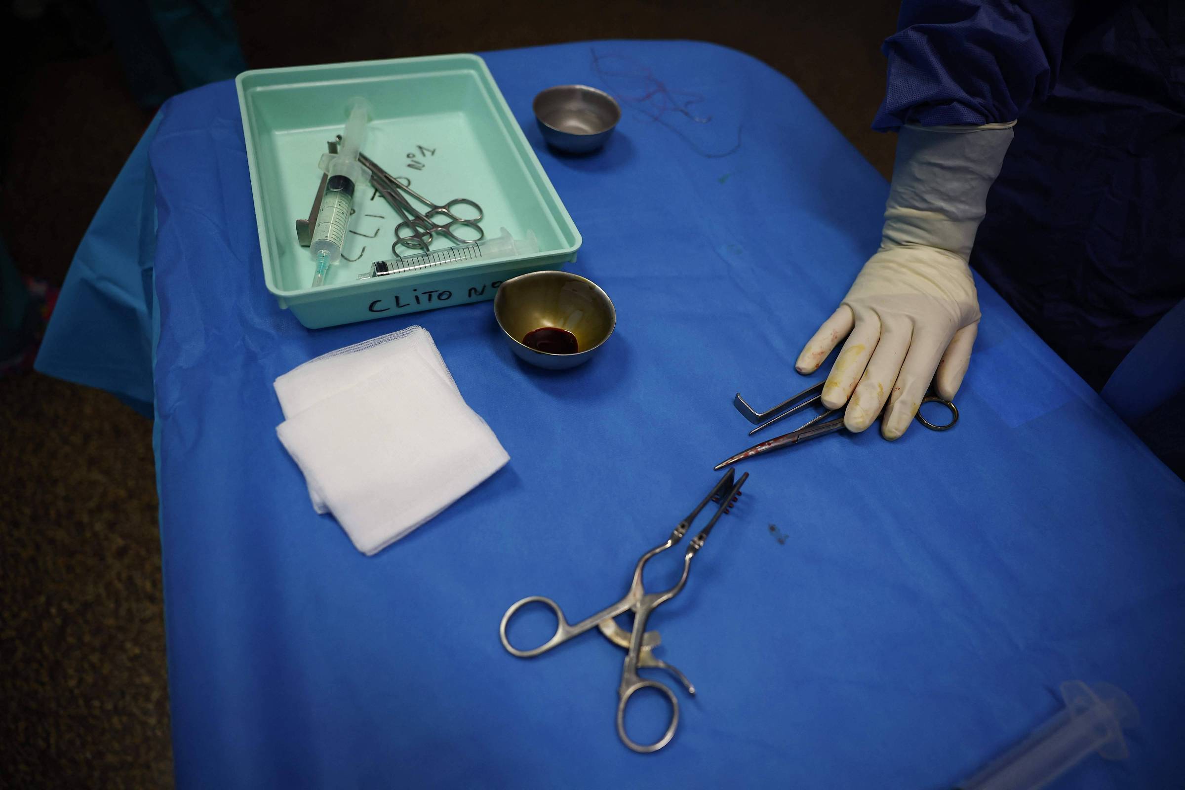 Estudos encontram falhas em esterilização de instrumentos cirúrgicos