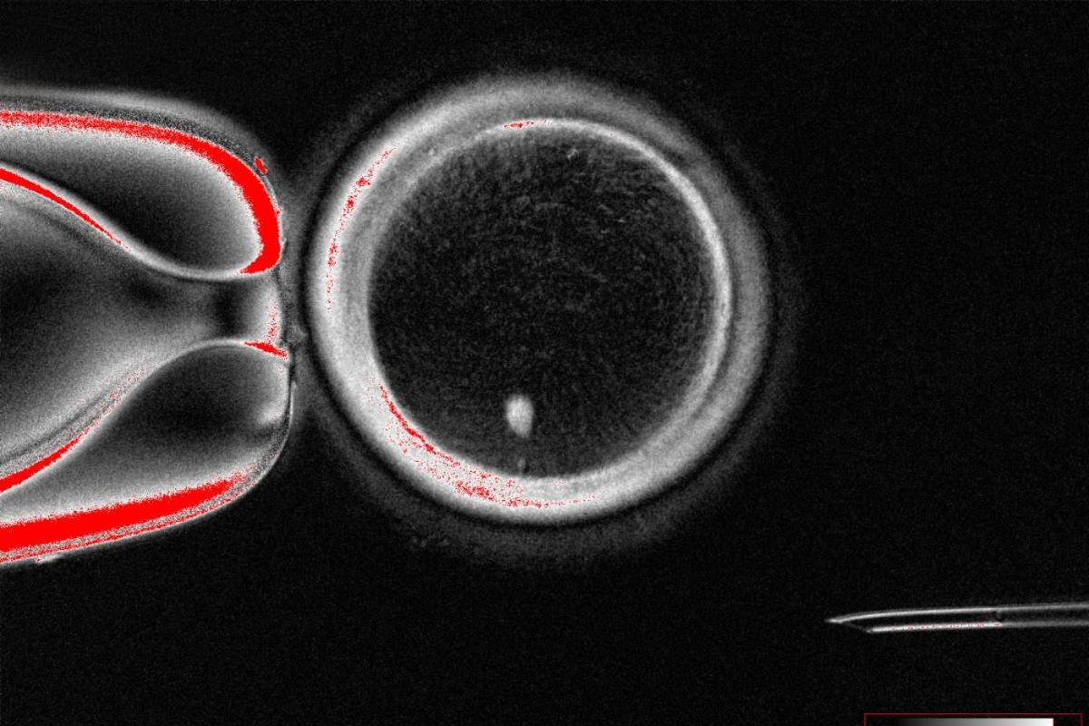 Com tecnologia de clonagem, cientistas usam células da pele para gerar óvulos