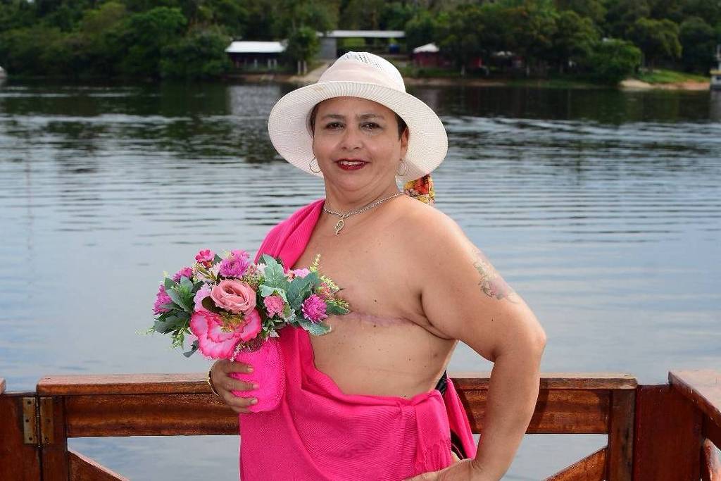 Como o silêncio sobre sexualidade no tratamento do câncer de mama afeta a qualidade de vida