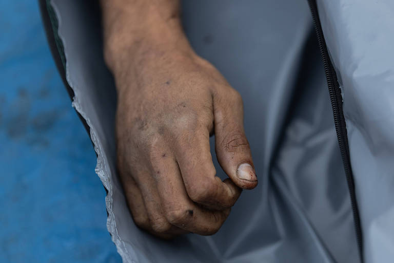 Mão masculina com sujeira visível na pele e unhas, parcialmente coberta por tecido cinza com zíper preto, sobre fundo azul.