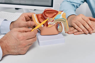 Doctor consulting man patient with suspected prostate cancer using male reproductive system model while visit in urology clinic. Prostate problems and treatment