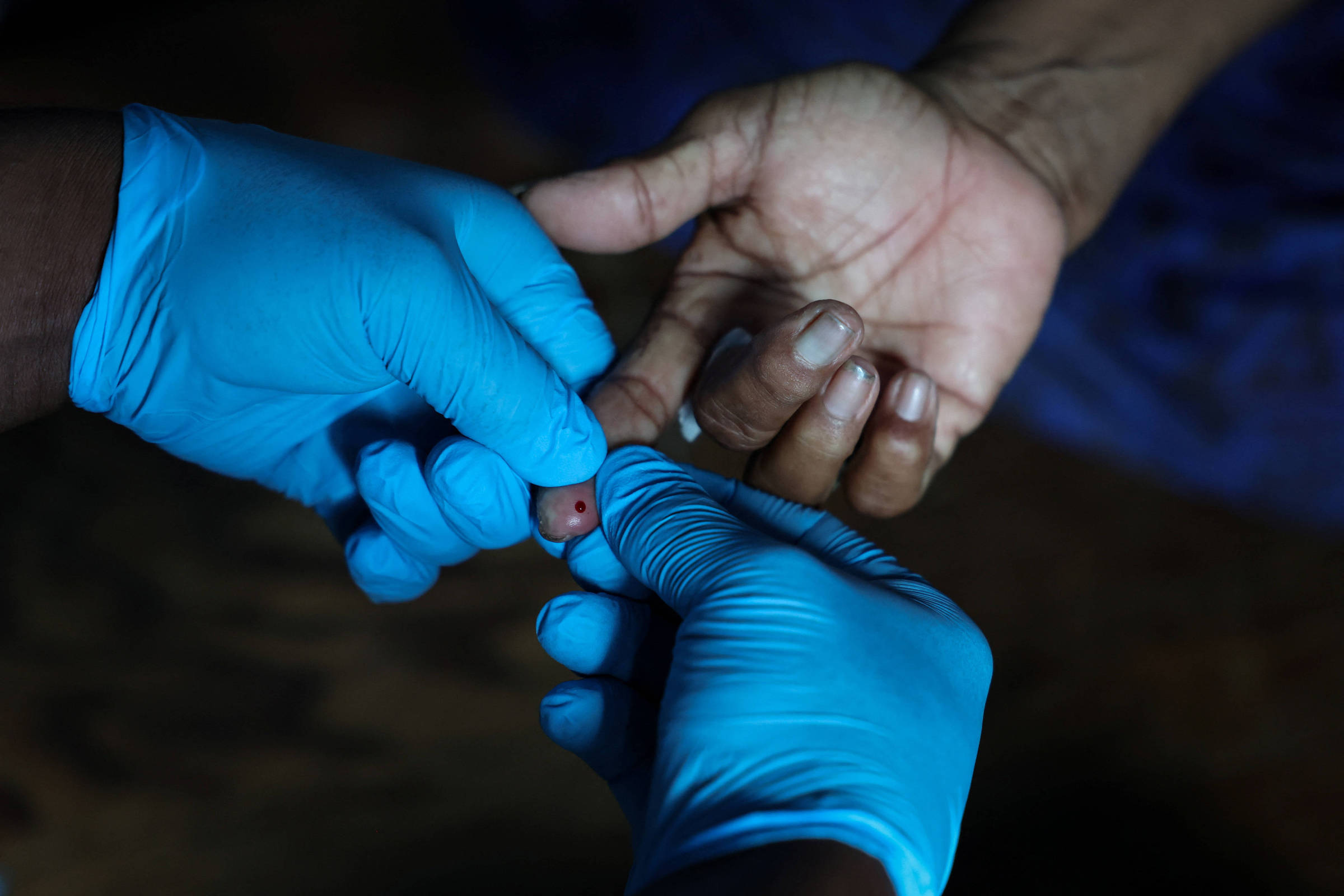 Por que diabetes tipo 1 é mais grave em crianças pequenas