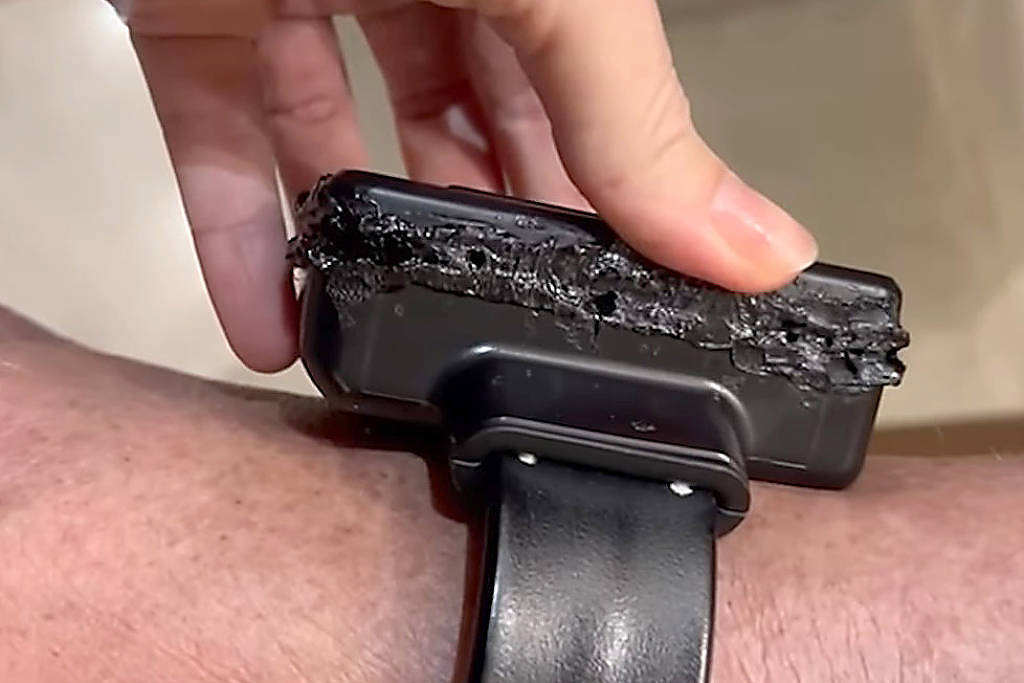 Entenda como funciona uma tornozeleira eletrônica como a de Bolsonaro